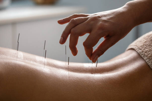 Acupuncture in Sports Medicine and Athletic Injuries